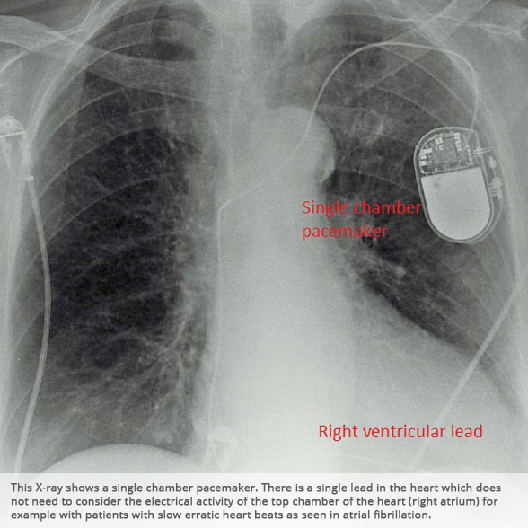 Dr Bogdan Nuta Xrays and descriptions of cardiology procedures