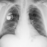 Learn more about heart conditions and methods used for treating them